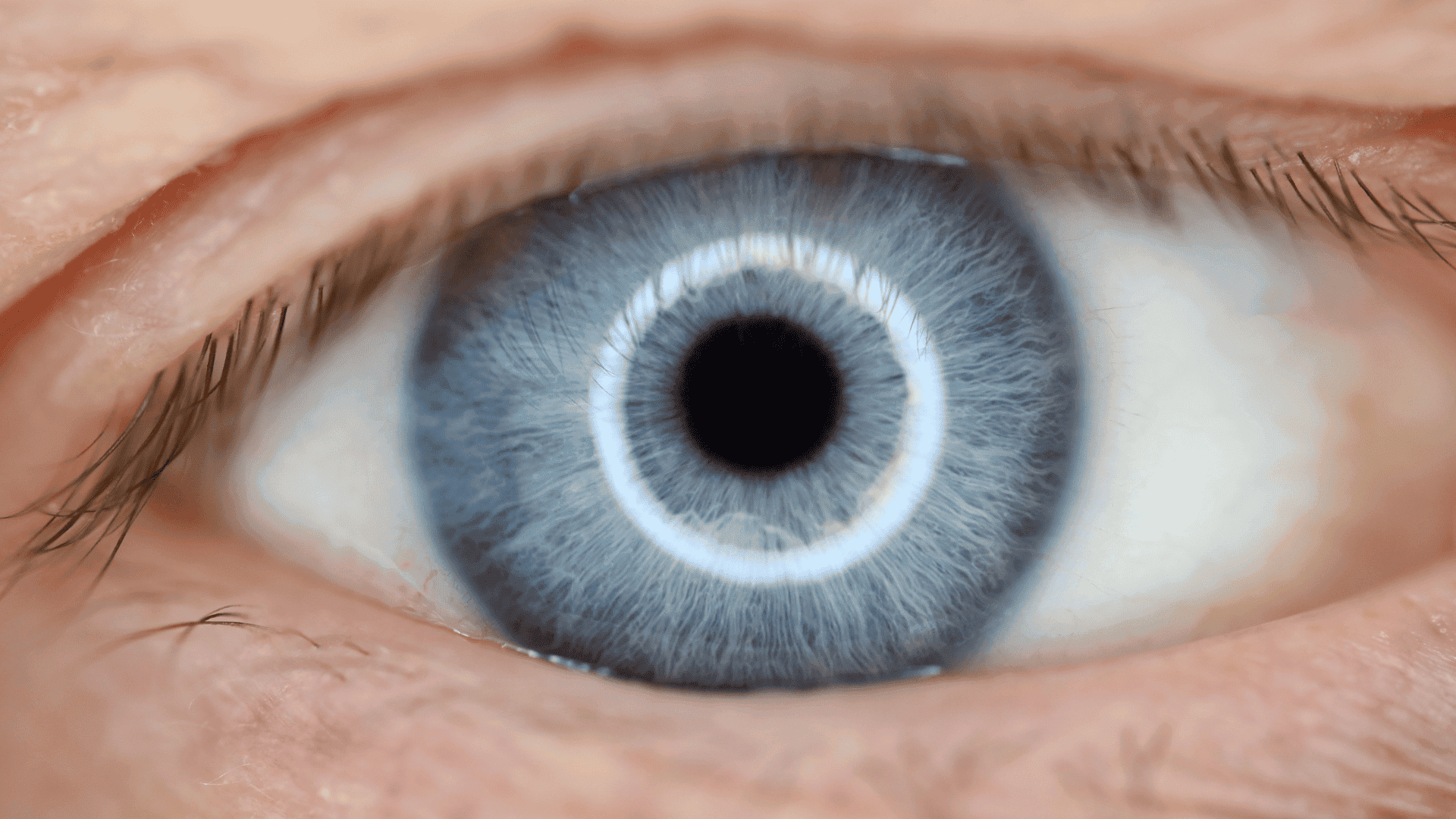 Correzione Ottica