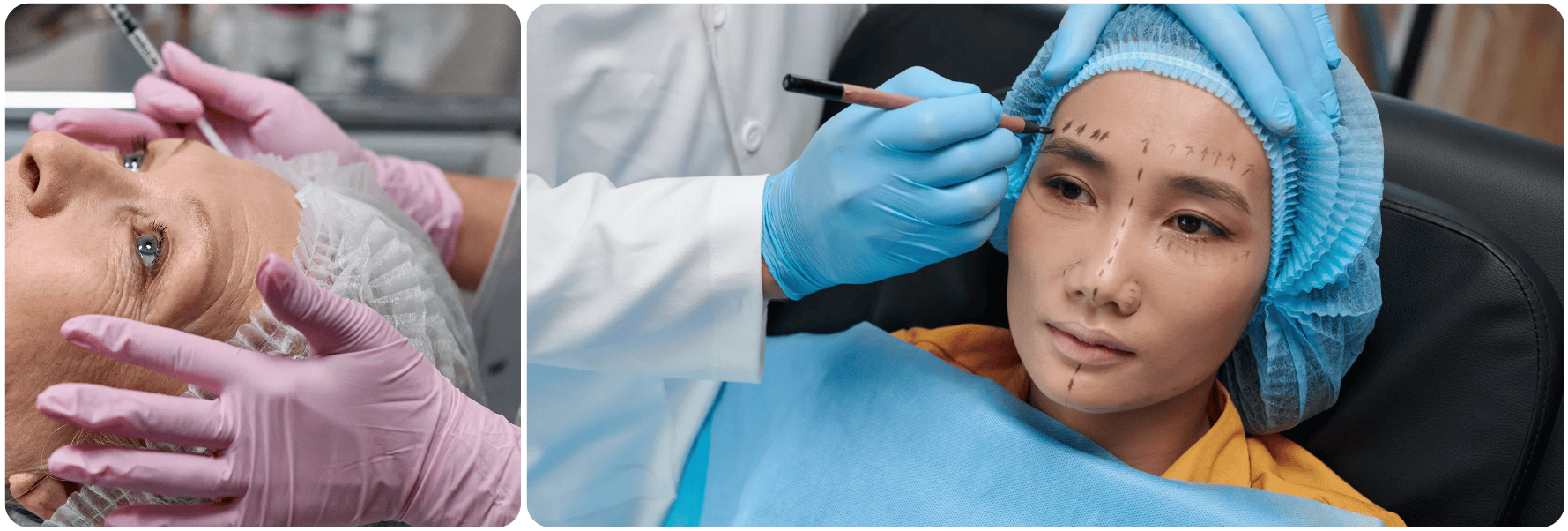 Fractional CO2 facelift.png