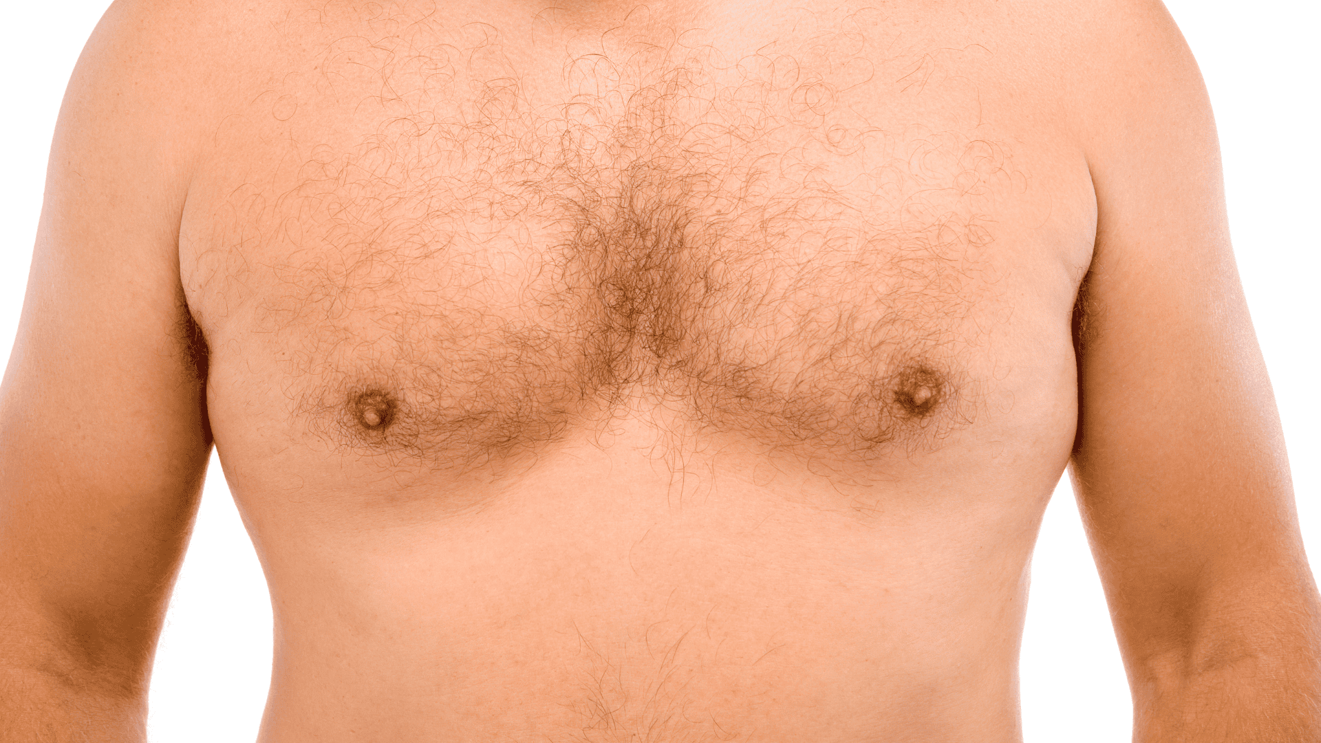 Gynäkomastie-Operation? Alles, was Sie wissen müssen