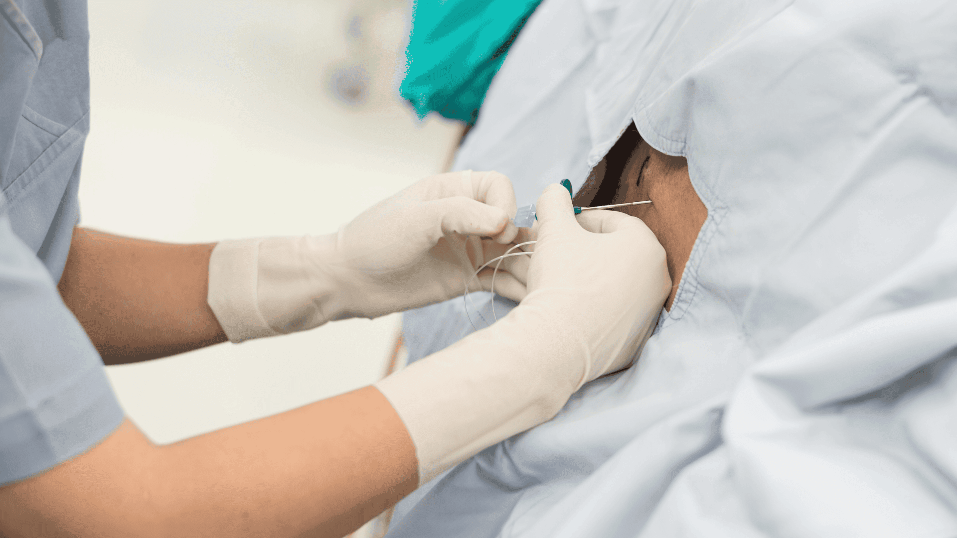 Iniezione Epidurale di Steroidi