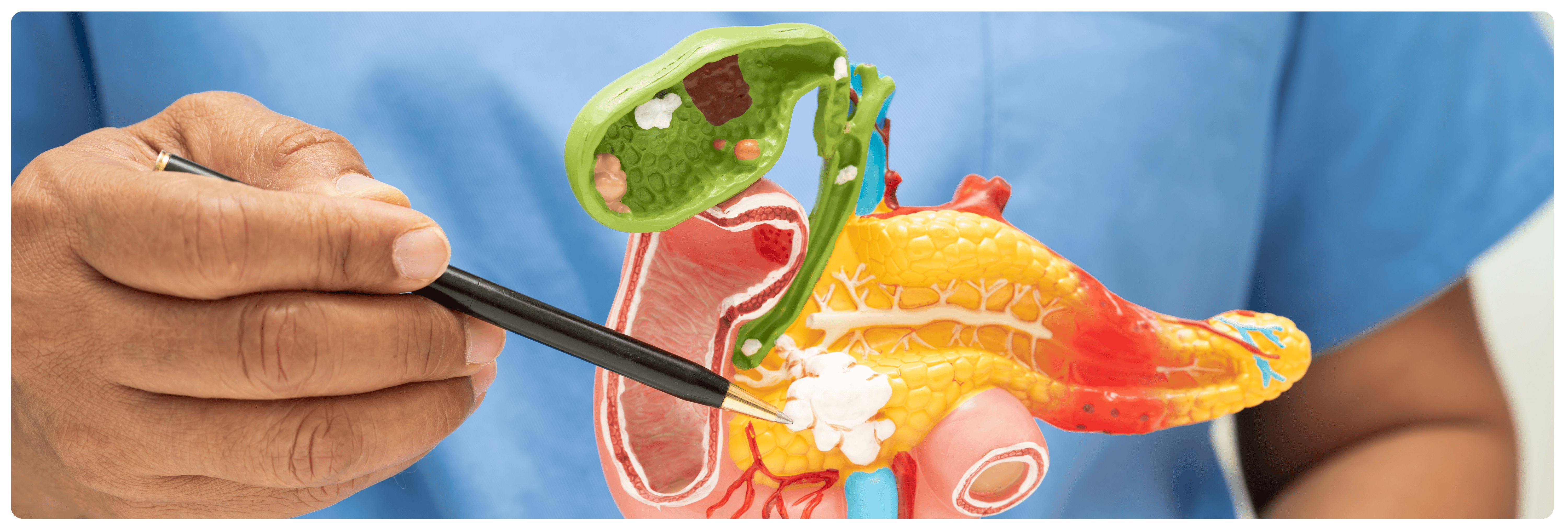 La cholecystectomie