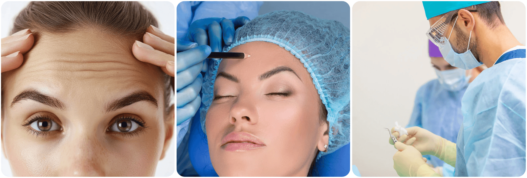 Lifting de Frente fore head lift voorhoofd .png