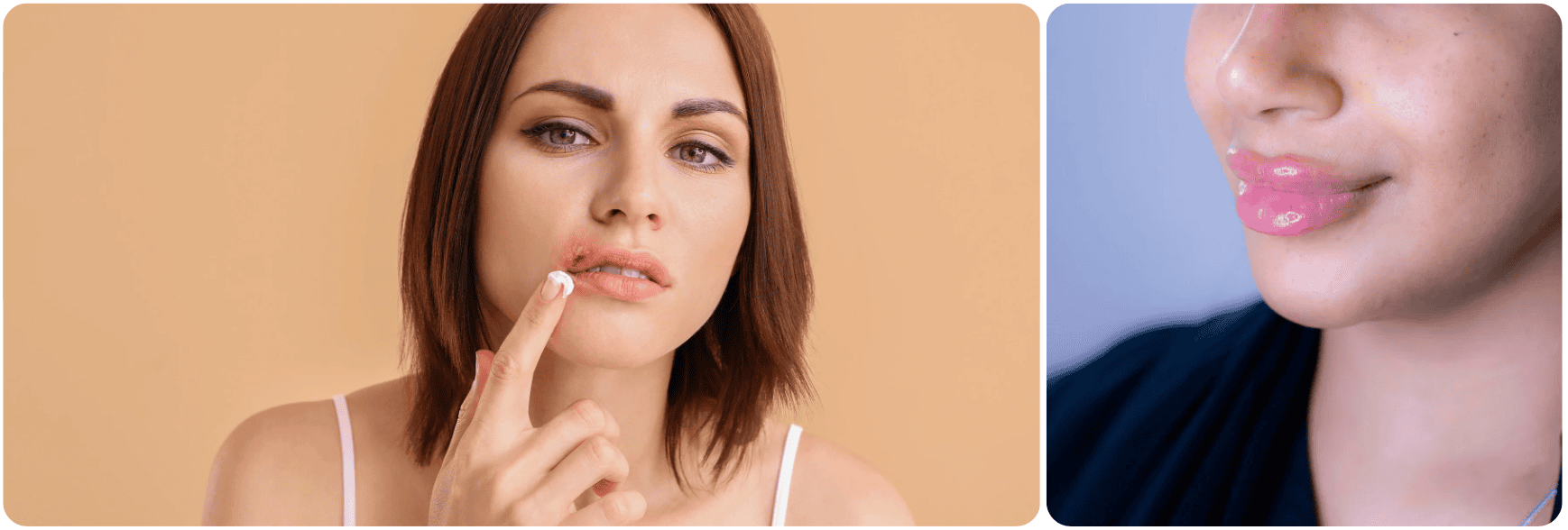 Reconstrucción de Labios.png