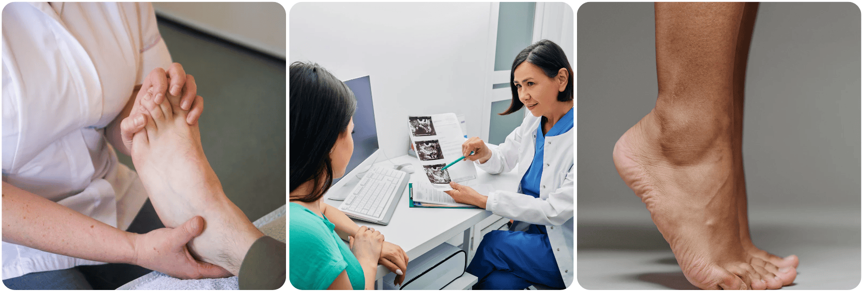 Tratamiento de la Tendinitis Feet voet.png