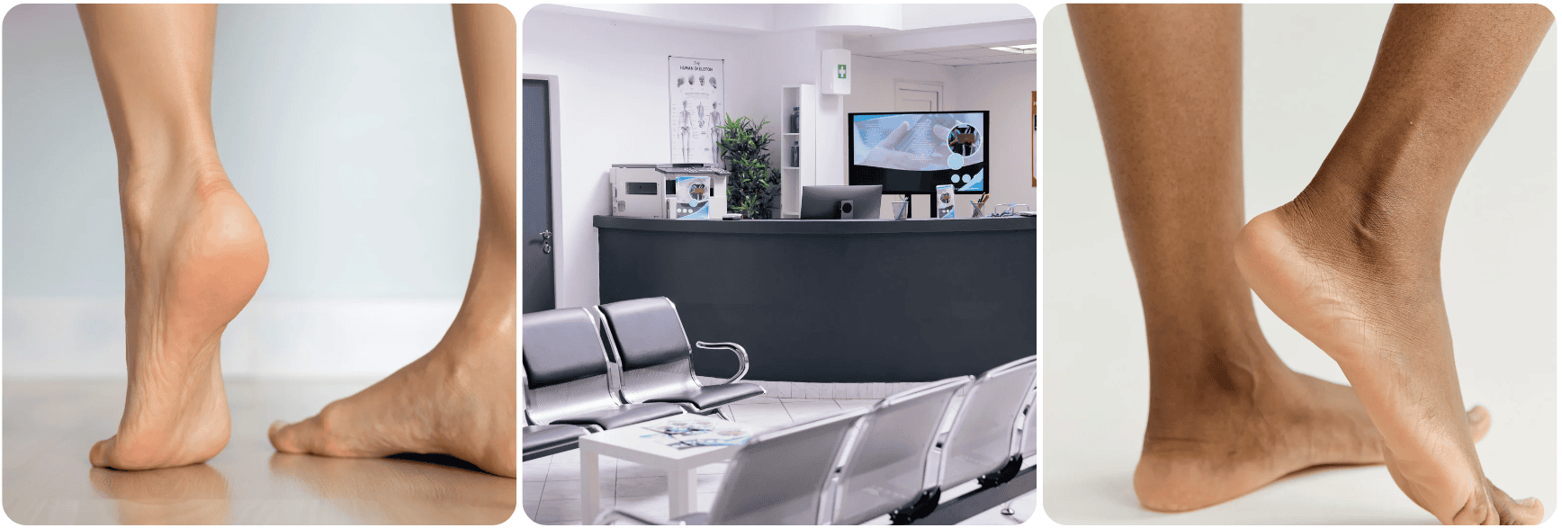 Tratamiento de la Tendinitis voet feet.png