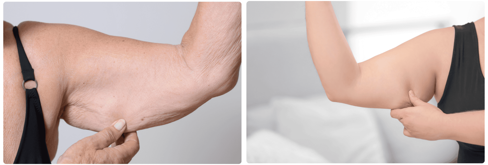 arm lift.png