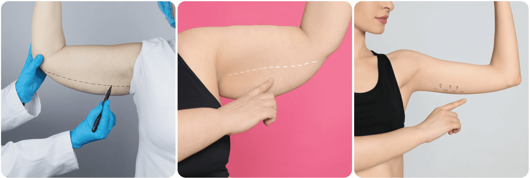 armlift.png