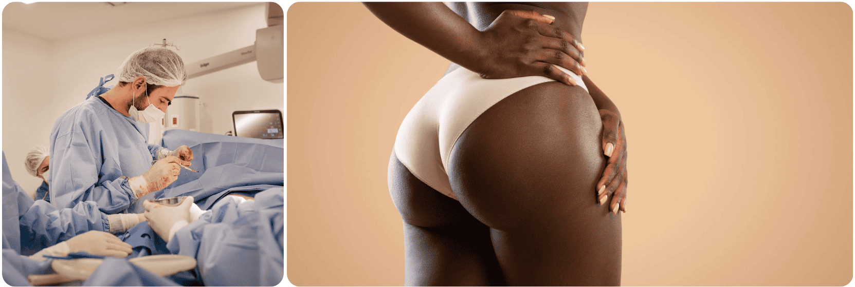 bilimplantaten butt lift.png