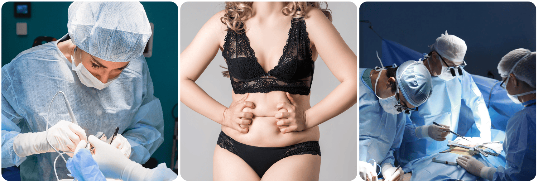 buik tummy tuck correctie .png
