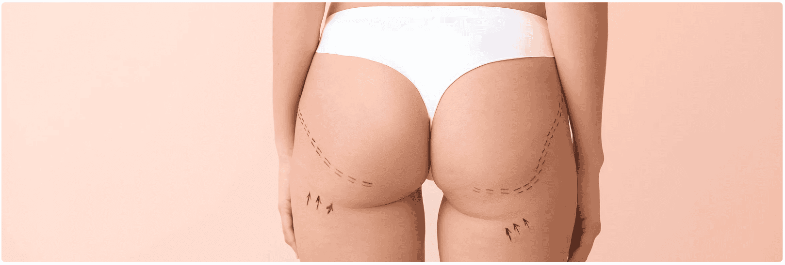 buttlift.png