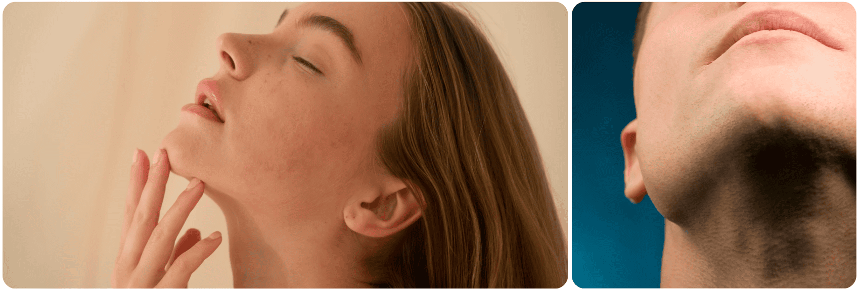 chin implant kin.png