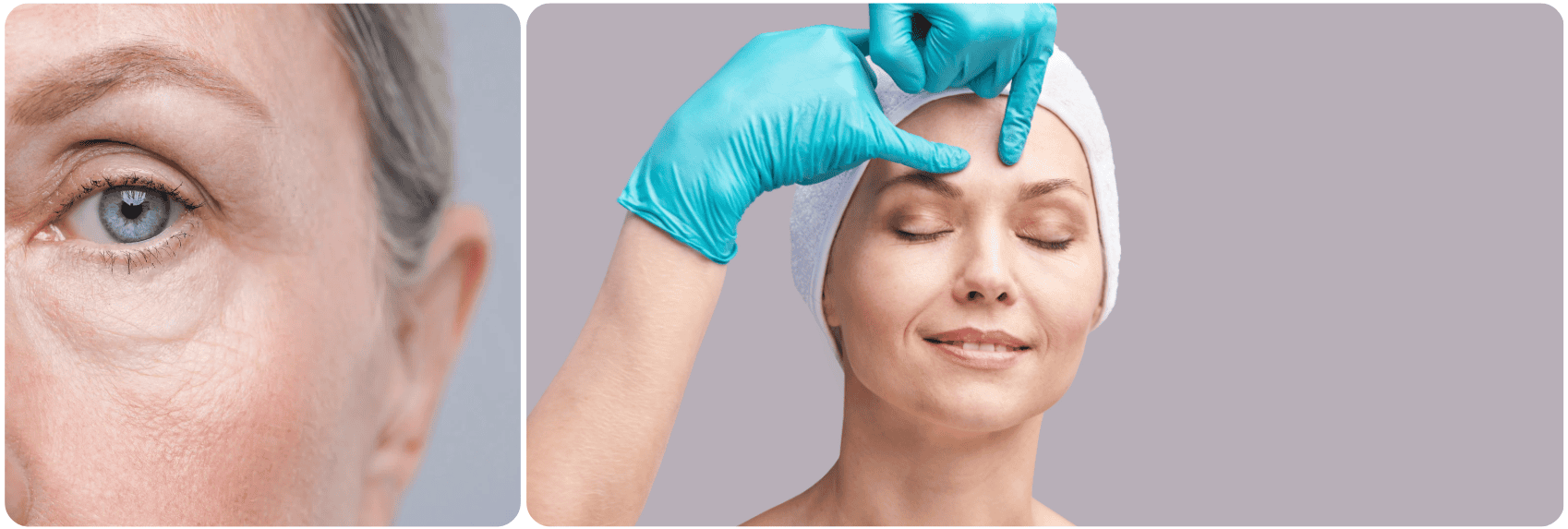 facelift Lifting du Milieu du Visage.png