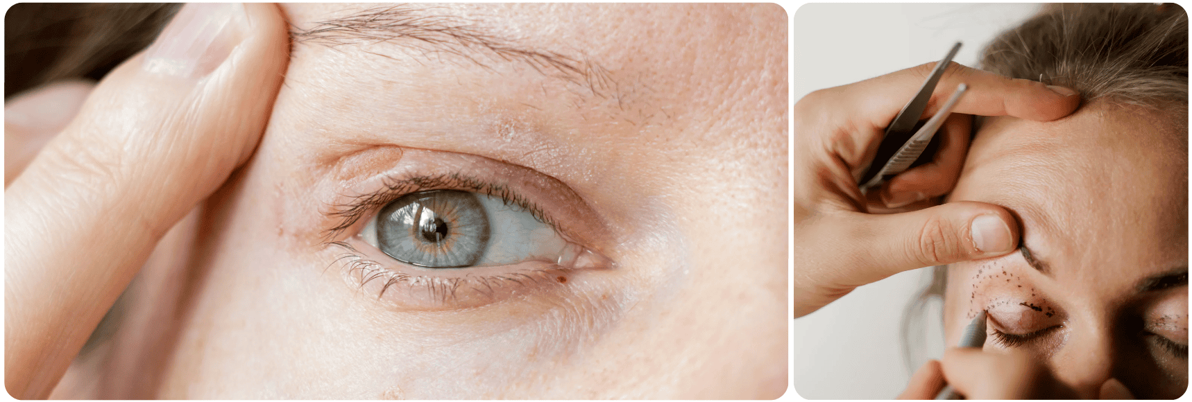 goz kapagi ooglid.png