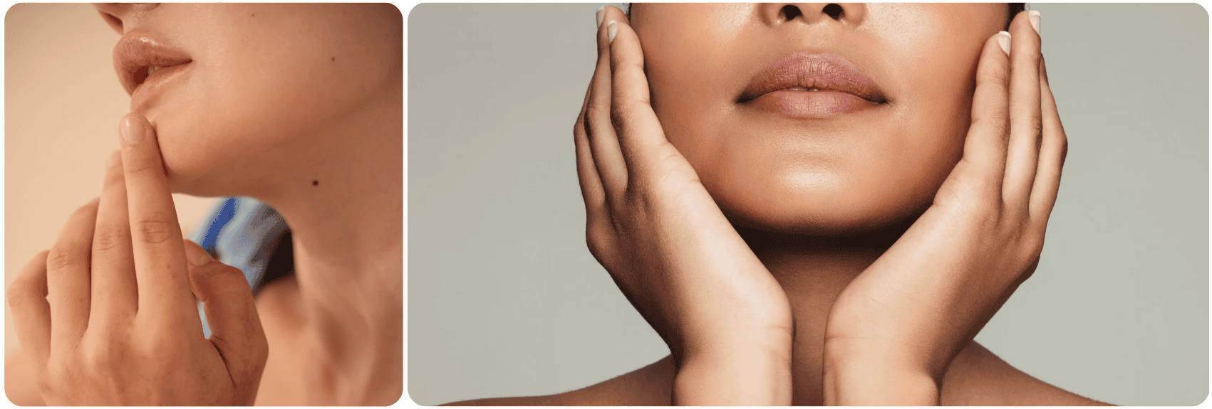 implant kin chin.png