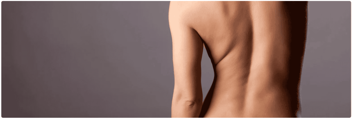 lipo 360.png