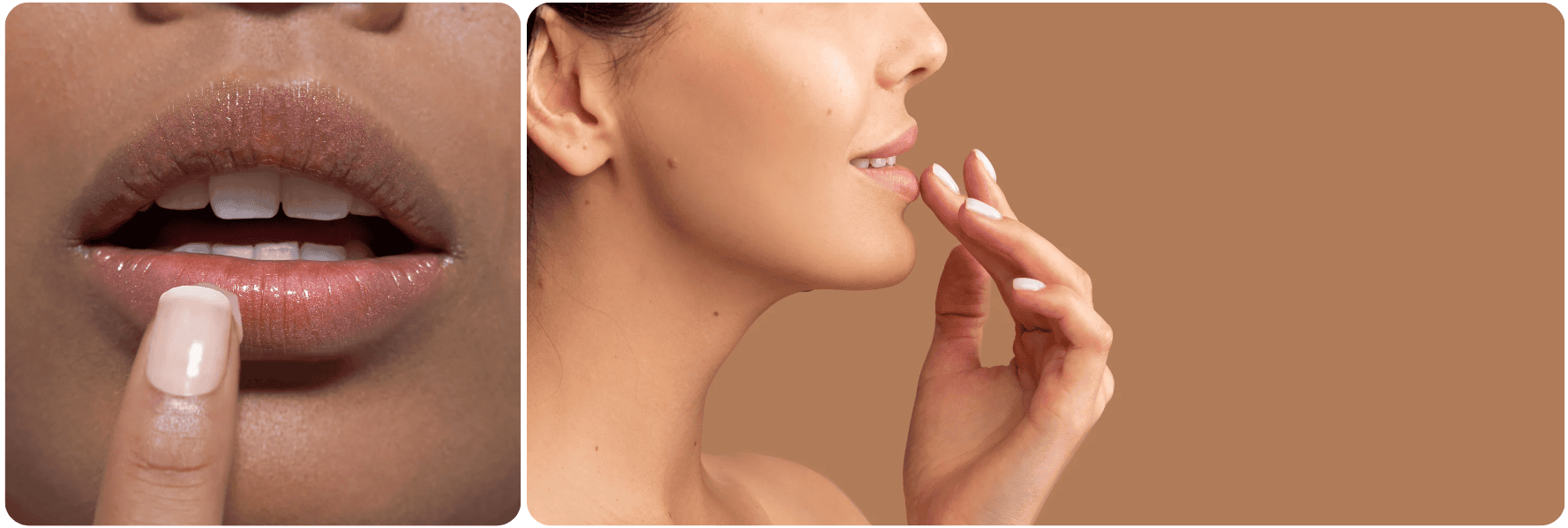 lips lipfiller lippen.png