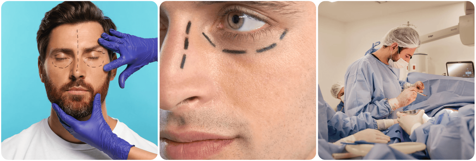 men nose job.png