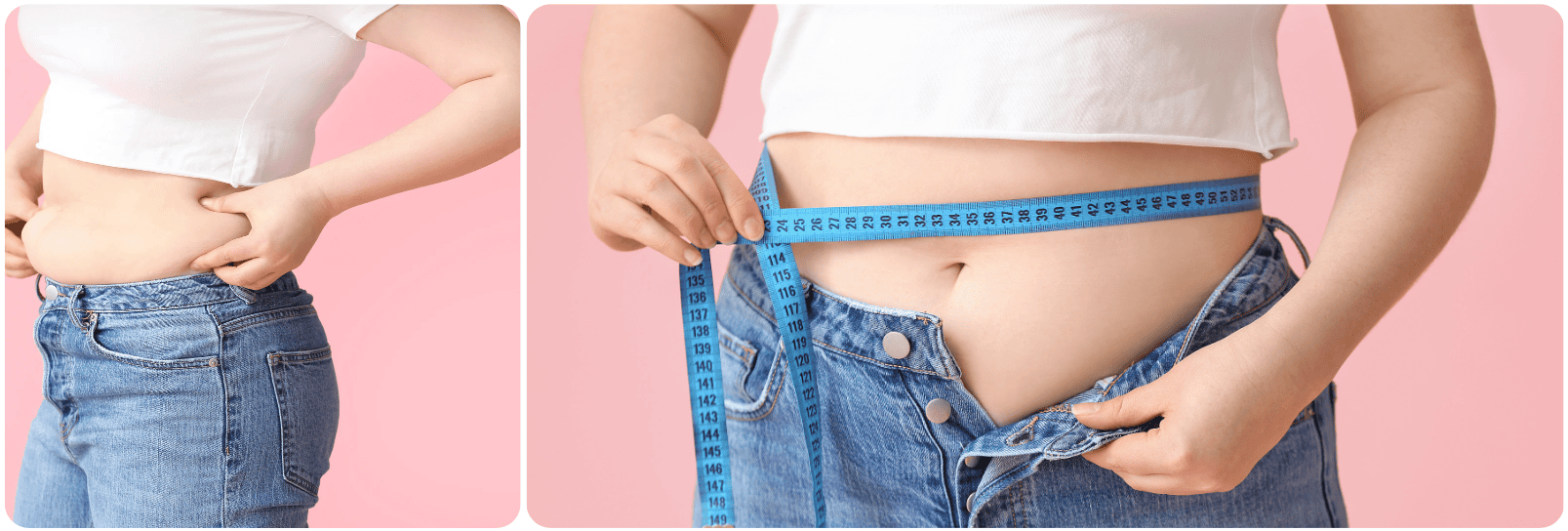 mini-abdominoplastiek buik lipo.png