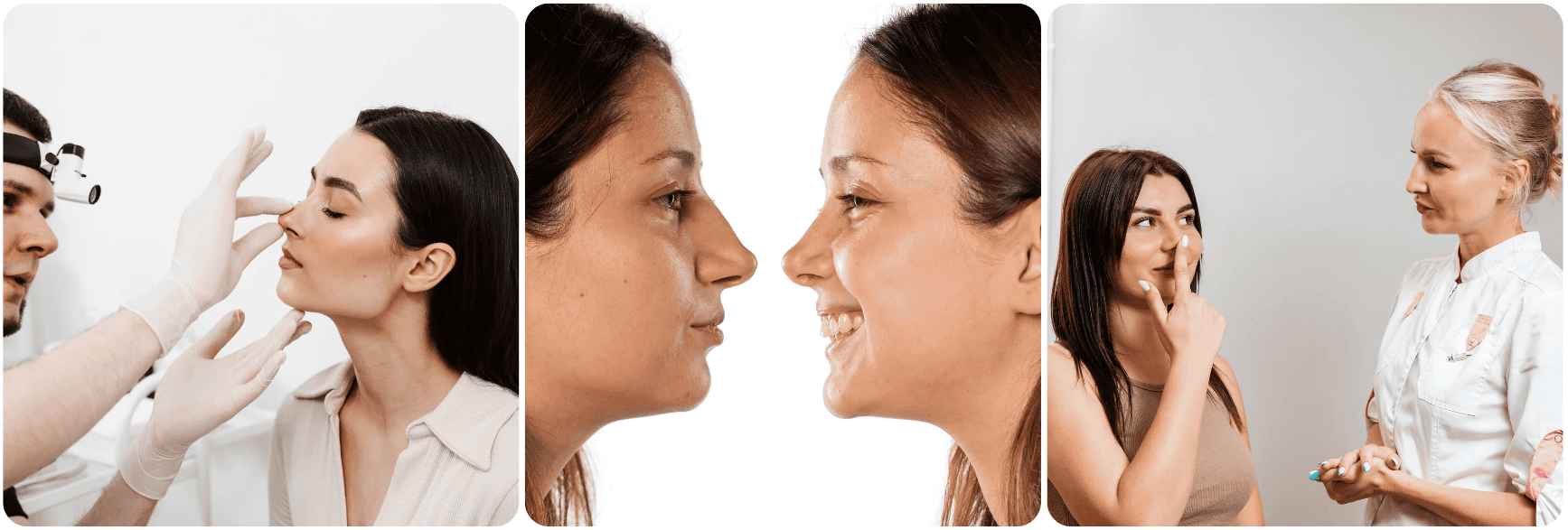 neuscorrectie rinoplasty1 .png