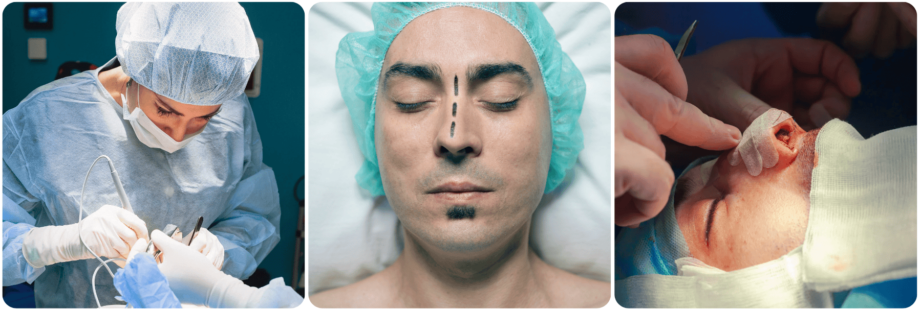 nose men surgeryy .png